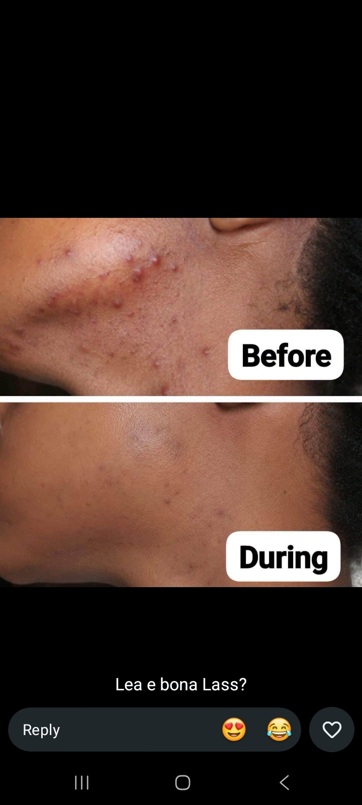You want a solution to your skin? Look no further my love Lass SkinCare is your baby... wa.me/266679