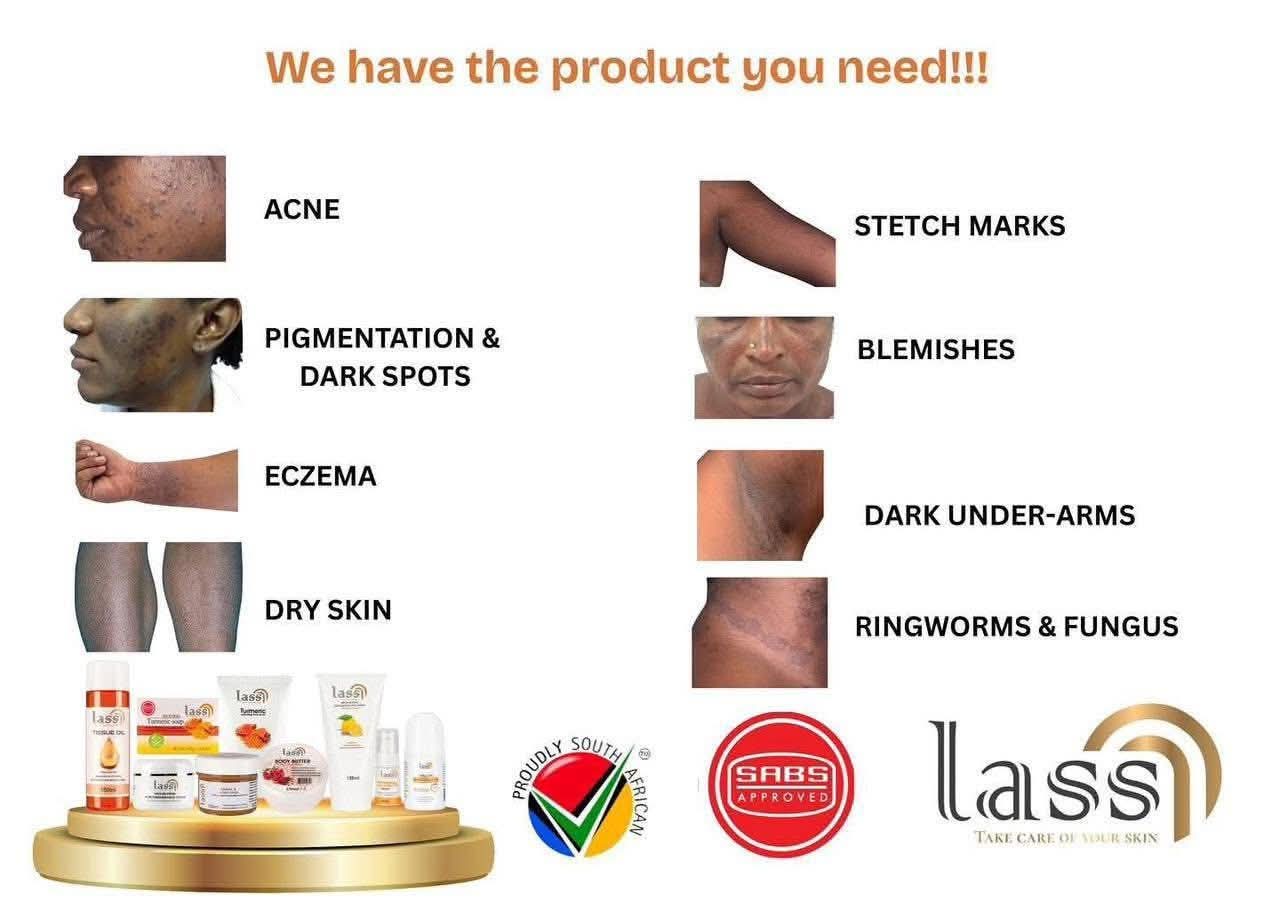 Bakeng sa makhopho, menyama,  dark spots, botsho mahafing le molaleng le hohle moo sa bo batleng ten